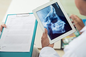 Dentist looking at x-rays of skull and jawbone